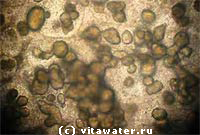 Скопления гранул неправильной формы (узелковые утолщения) во внутренних органах - колонии туберкулезных бактерий, окруженные соединительной тканью рыбы.